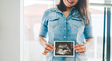 woman holding a picture of a songogram in front of her belly